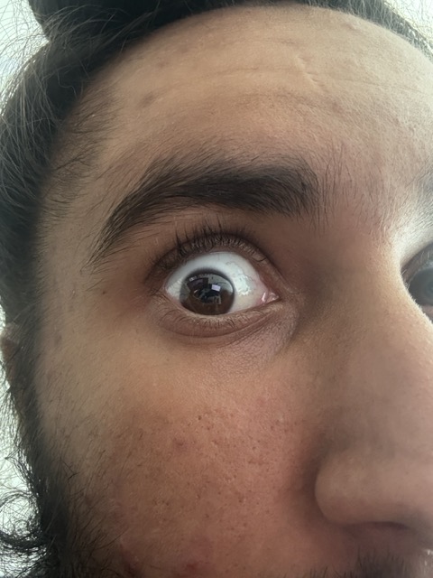 Eye