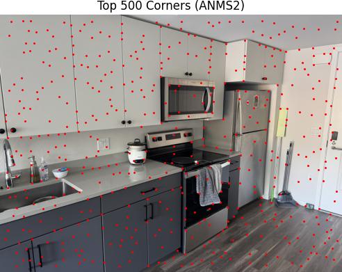 ANMS Results 2